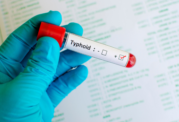 Typhoid
